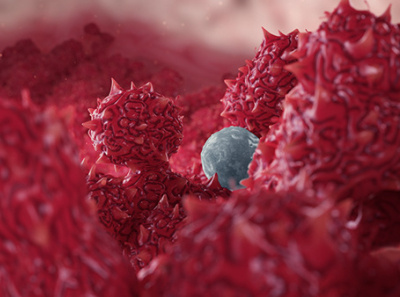 Of Proteins and Tumors pixologic zbrush