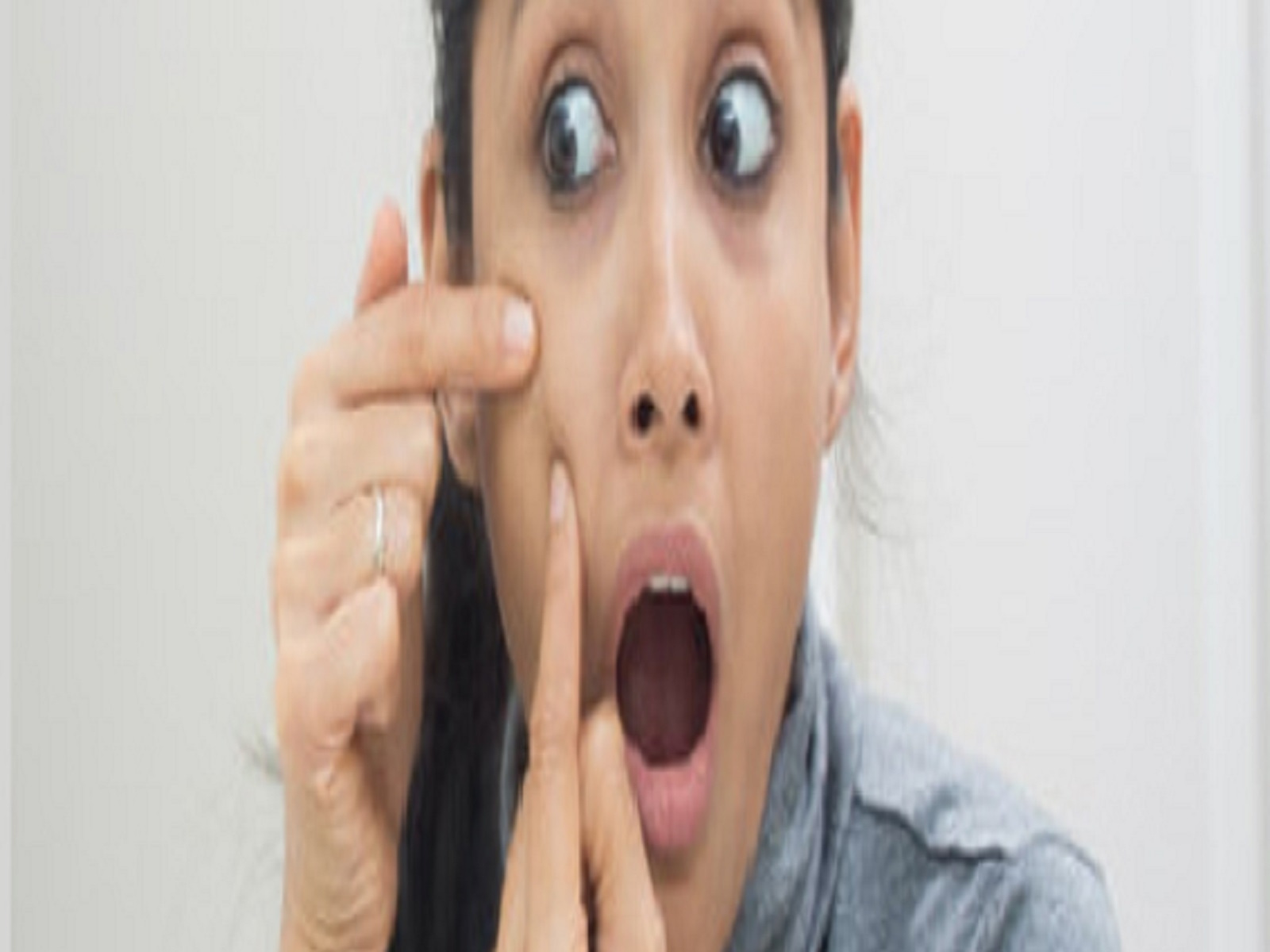 Acne Laser Treatment In Chennai Relooking.co.in by Presidential