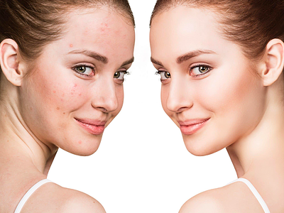 Skin Retouching Services graphic design image enhancement photo editing photo retouching