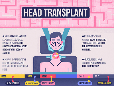 Head Transplant Infographics anatomy flat design head transplant illustration infographic infographics medical medicine neuroscience neurosurgeon sergio canavero