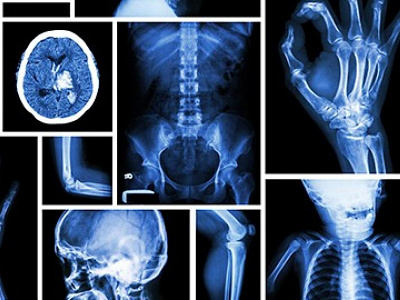 Radiology Imaging Systems radiology imaging systems