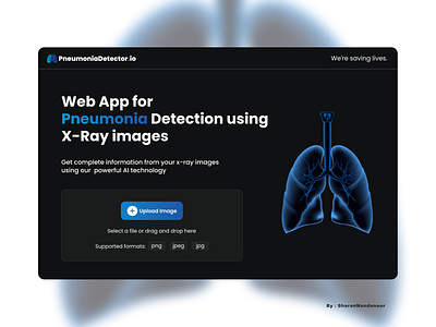 Simple Landing Page UI Design in Figma landingpage pnemonia ui upload