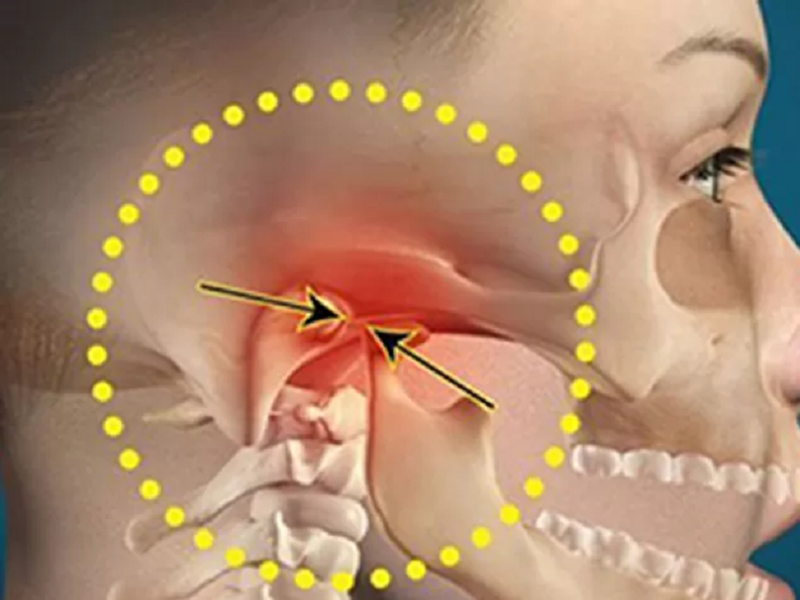 TMJ Treatment Specialist Calgary TMJ Dentist in Calgary by Galaxy