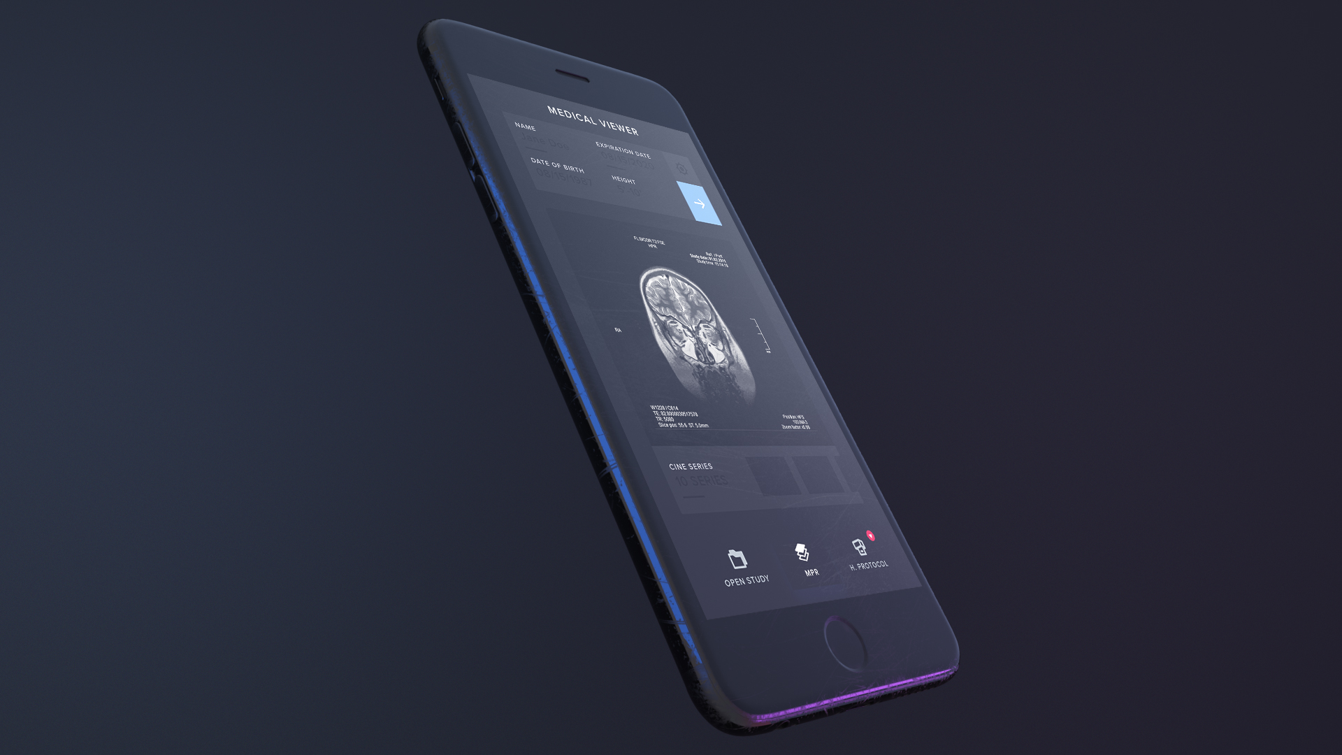 Free Dark iPhone Mockup by Fernando Martinez on Dribbble