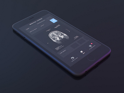 Free Dark iPhone Mockup 