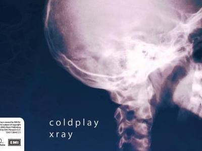 Coldplay Xrays art blue bones cd coldplay concept cover design emi music polydor records vinyl xray xrays