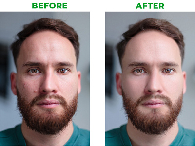 Face Spot Remove and Retouch | Deap Clipping | background remove clipping path deap clipping design ecommerce background removal face spot removal graphic design illustration image background remove logo model background removal photoshop retouching retouch retouching ui