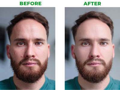 Face Spot Remove and Retouch | Deap Clipping |