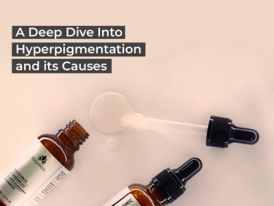 Hyperpigmentation Face Serum | Reduces pigmentation On Face. acne oily skin products skincare