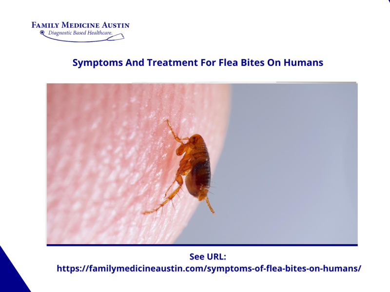 Symptoms And Treatment For Flea Bites On Humans by Family Medicine ...