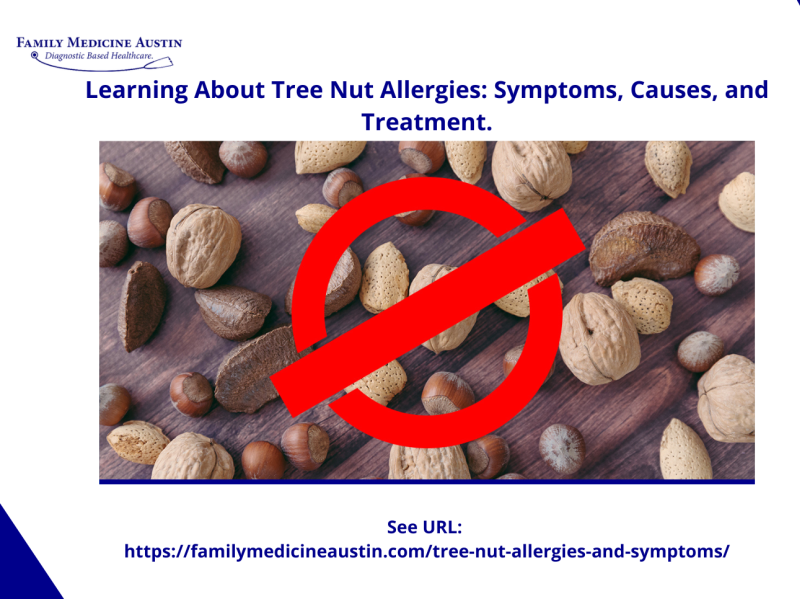 Tree Nut Allergy How Can You Be Allergic to Them by Family Medicine