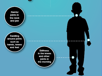 Juvenile Arthritis Infographic graphic design infographic