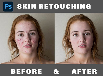 Skin Retouching image edit image editing photo edit photo editing photoshop editing retouching sherazt skin skin retouch skin retouching