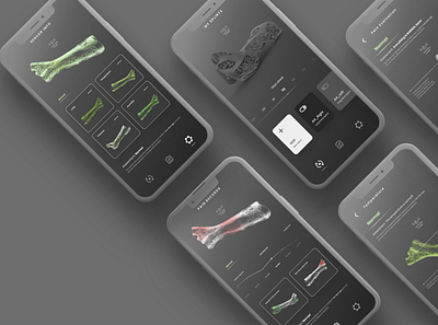 Smart Splint app application design health interaction ui ux
