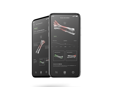 Smart splint app design interaction ui ux