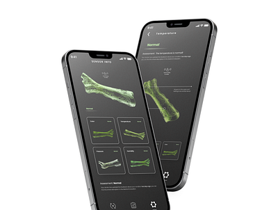 Smart Splint app application design interaction ui ux