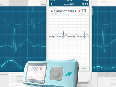 ECG monitor app app bluetooth ecg medical app ui