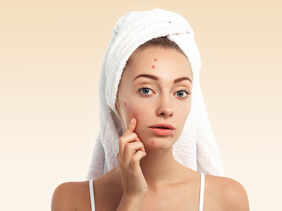 best way to treat acne scars best way to treat acne scars