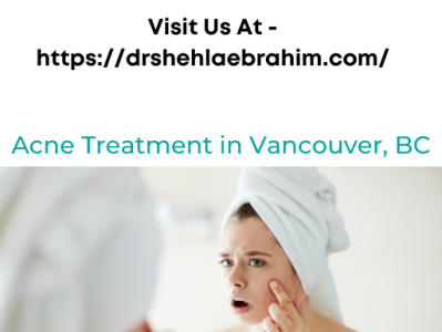 Acne Treatment in Vancouver, BC