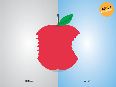 Awesome Advertise Before and After Dental Clinic advertise after apple apple design awesome design background before brilliant design flat illustration vector
