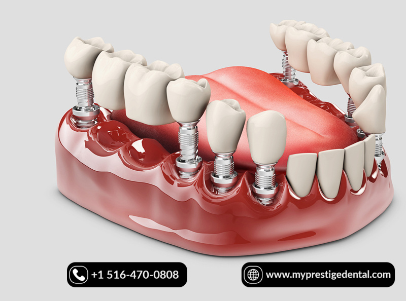 Get Fixed & Flexible Dentures in Floral Park & Hicksville. by Prestige