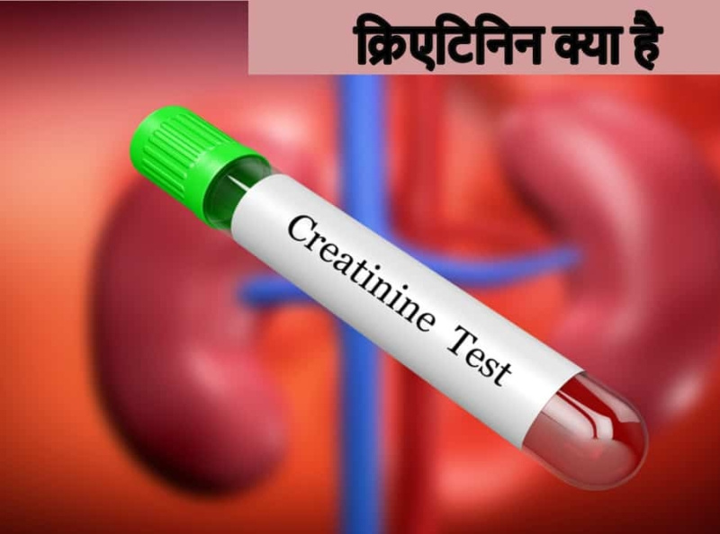 A Big “NO” To These Foods To Reduce High Creatinine? by Store.Ayukarma