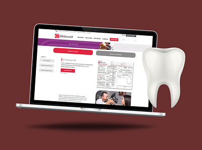 Glidewell Dental "Send Case" Website Redesign glidewell gvbe redesign ux uxdesign website