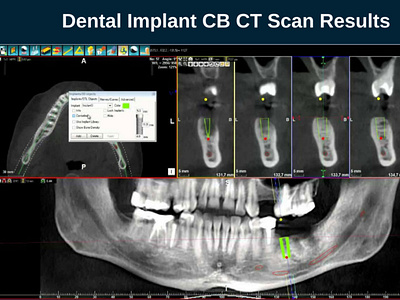 micro CT Scans - Dental Scan Centre by Dental Scan Centre on Dribbble