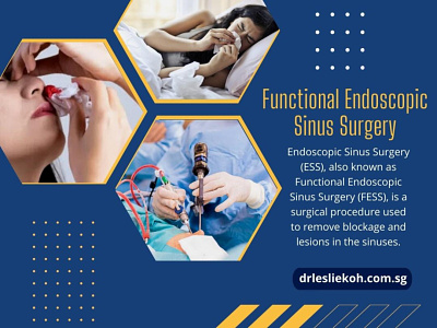 Functional Endoscopic Sinus Surgery dr leslie koh