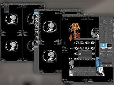 Medical 2D Film Viewer