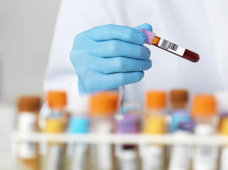 HOW SRL CONTINUOUSLY OFFERS THE BLOOD HOME SAMPLE COLLECTION by SRL