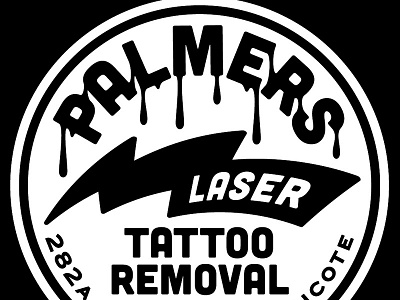 Palmers Laser Tattoo Removal laser palmers removal tattoo