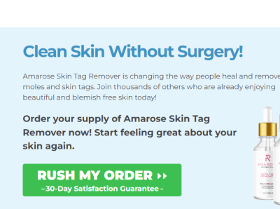 Amarose Skin Tag Remover [Reviews & Side Effects] Beware Before animation