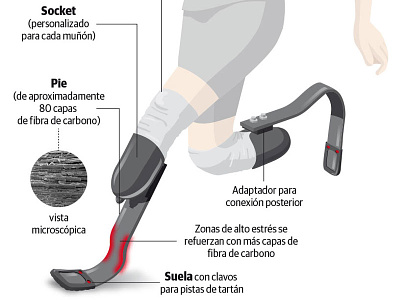 Prosthetic foot infographic