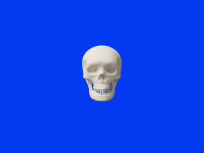 Archlifter Device - Skull animation c4d device medical motion design redshift