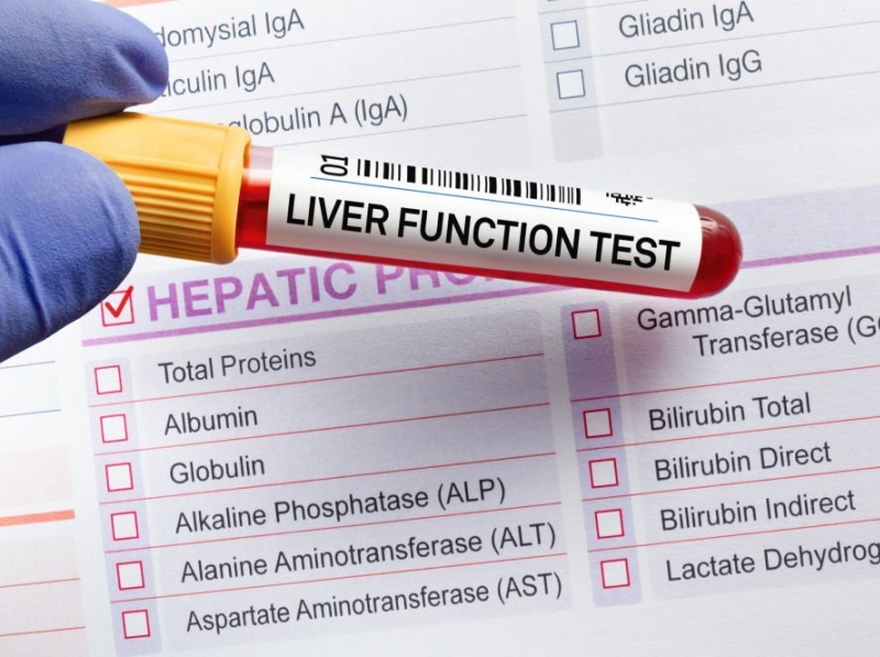 All You Need To Know About Liver Function Test by Imran Saify on Dribbble