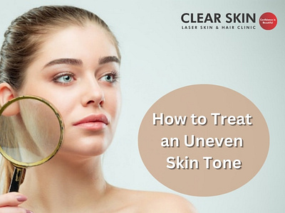 How to Treat an Uneven Skin Tone?