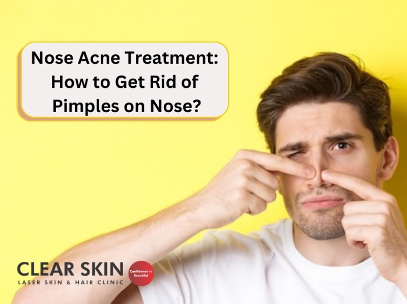 Nose Acne Treatment: How to Get Rid of Pimples on Nose? by Atharv Parekh on  Dribbble