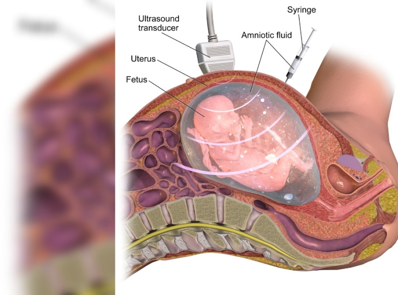 Adequate Liquor in Pregnancy Meaning, Normal Range of Amniotic by