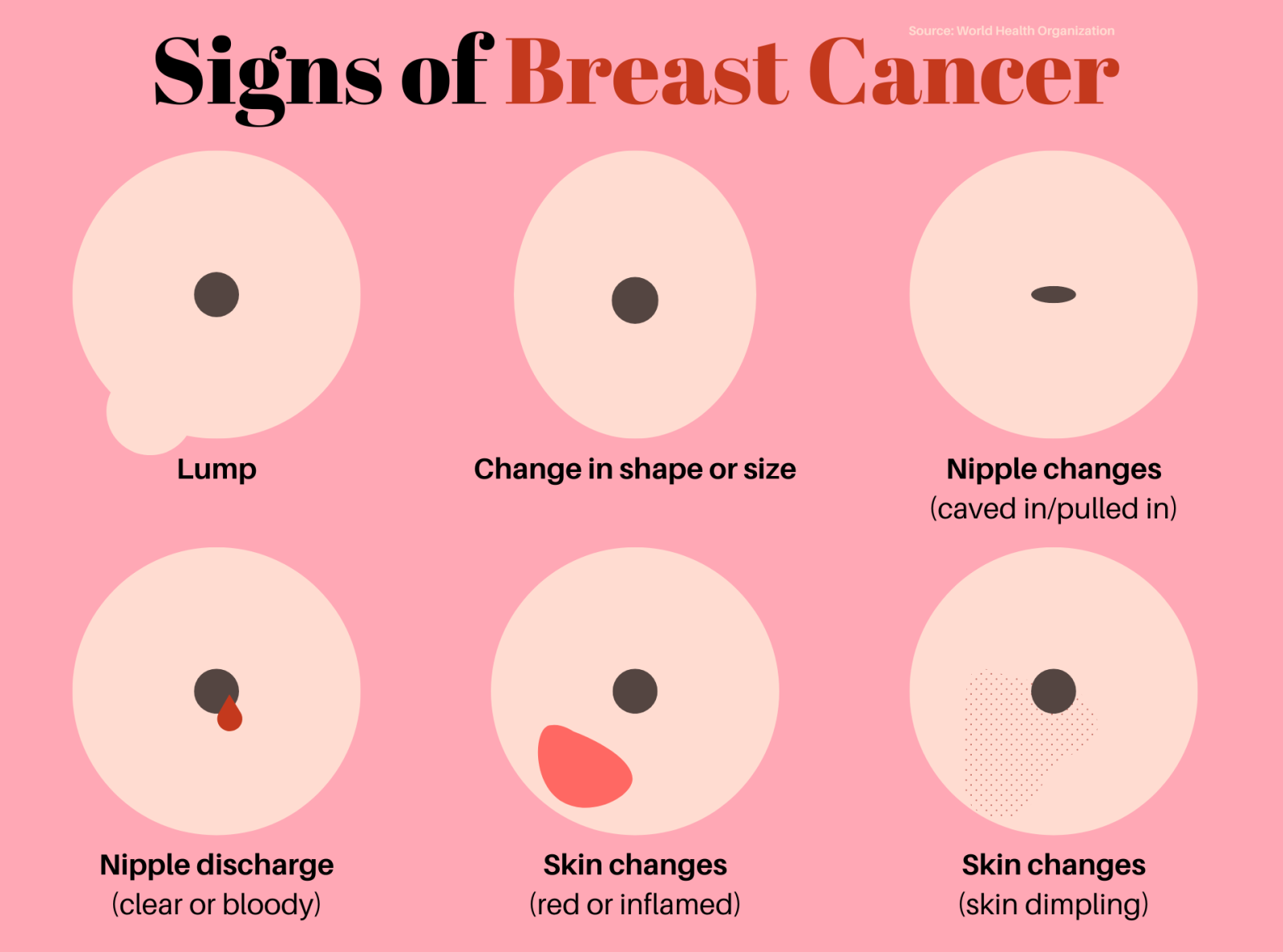 Pimples on Breasts: Causes, Treatment, When to See a Doctor