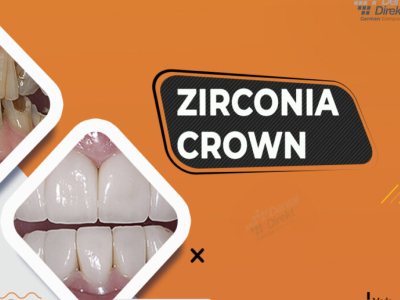 Zirconia Crown S Advantages By Dental Direkt India On Dribbble