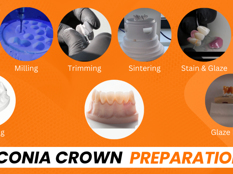 ZIRCONA CROWN PREPARATION by Dental Direkt India on Dribbble