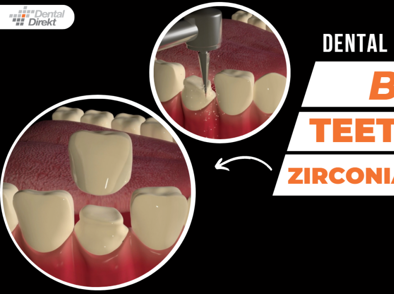 Dental Crowns (zirconia crown) can straighten crooked teeth by Dental