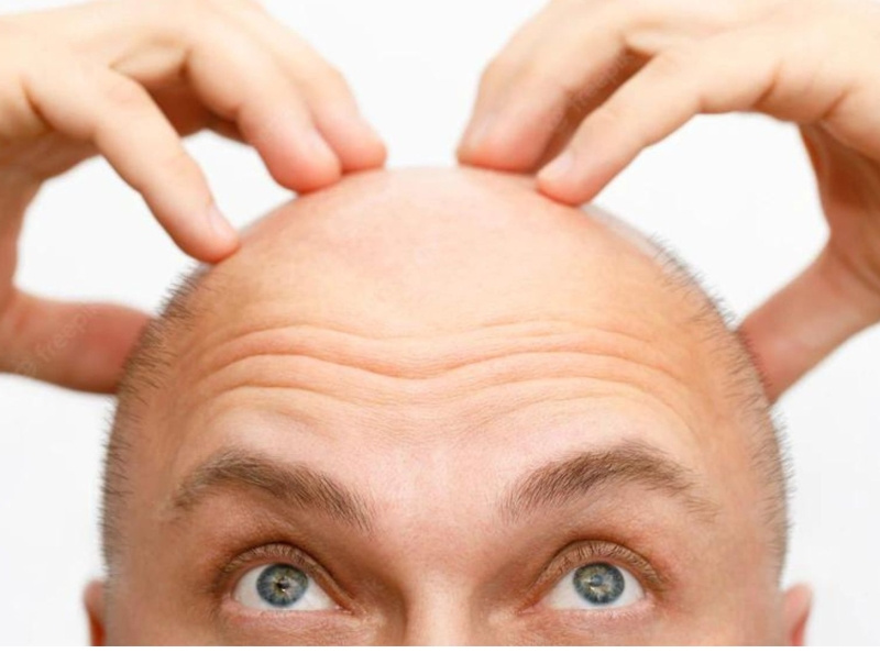 How Much Does Hair Transplant Cost? by Eugenix Hair Sciences on Dribbble