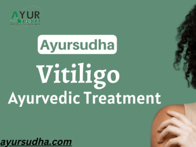 AYURVEDIC VITILIGO TREATMENT By Ayursudha On Dribbble