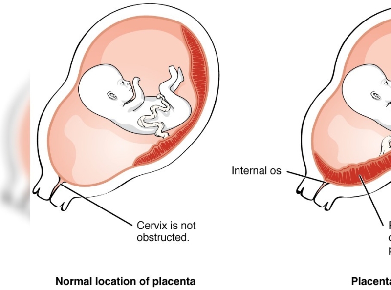 internal-os-closed-what-does-it-mean-in-pregnancy-scan-report-by-prega