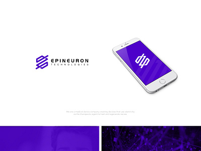 Epineuron Tech
