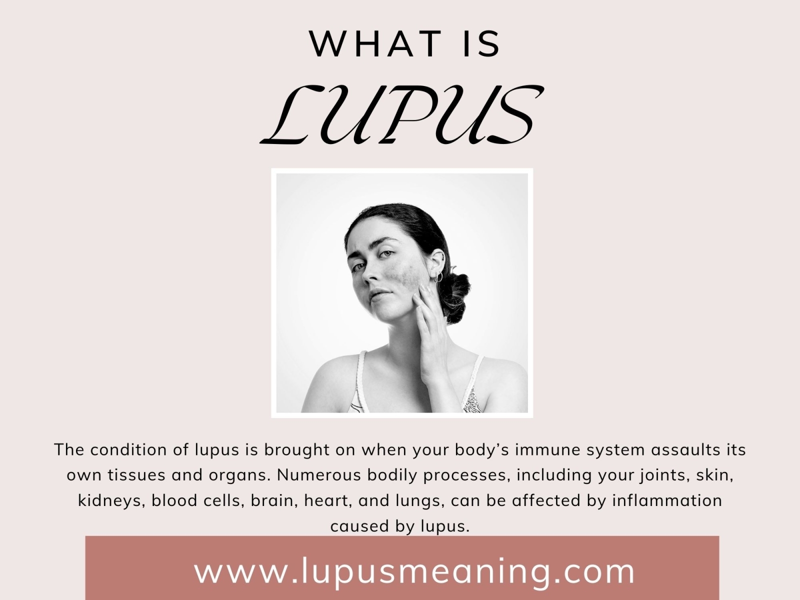 what-is-lupus-by-lupusca-on-dribbble