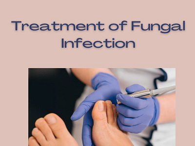 Treatment of Fungal Infection by fungal infections on Dribbble