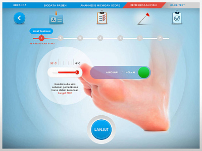 Neuropathy